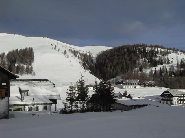 Bürgeralm